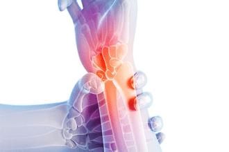 膝蓋痛 手指僵 你可能得了骨關(guān)節(jié)炎哦