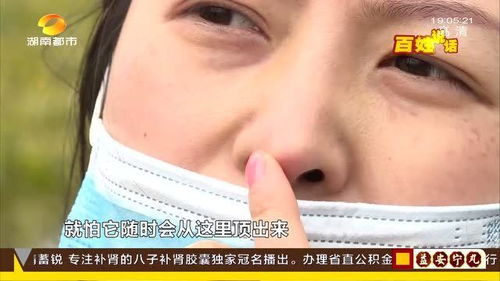做完鼻修復 竟能直接摸到肋骨 女子 害怕填充物沖破鼻頭