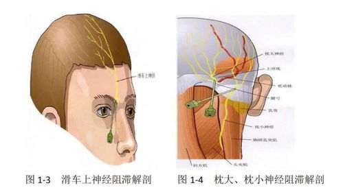 病例分享 癲癇病灶切除術(shù) 術(shù)中喚醒麻醉