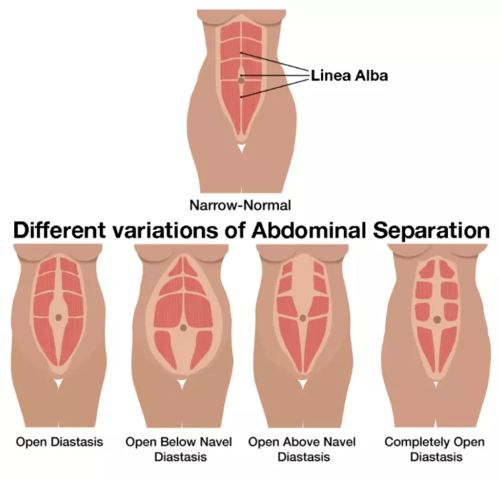 滿月發汗,卵巢保養,骨盆修復 這些雷區要避開