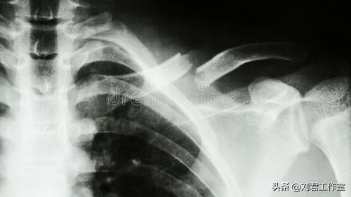 揭露 美軍歷史上真實發生的十大恐怖 人體實驗