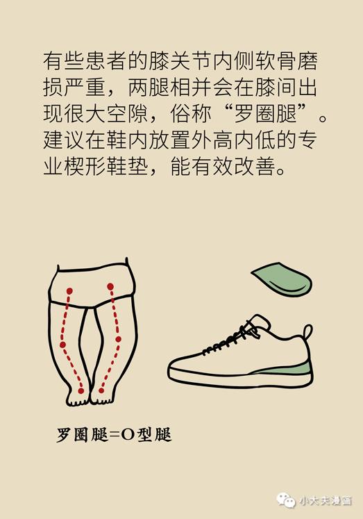 膝關(guān)節(jié)如何保養(yǎng) 骨性關(guān)節(jié)炎,關(guān)鍵是避免 屈膝過(guò)度