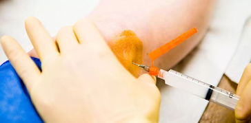 別讓膝關節比你先老 這些癥狀一出現,抓緊去治療