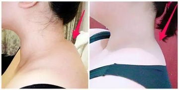 趕緊摸摸你的頸后，出現這種情況，再不重視就晚了——摸骨養生需警惕頸椎信號