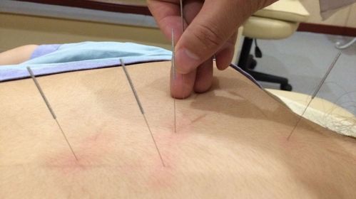 摸骨養生 輕松實用的健康之道