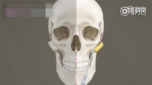 金希澈與Momo戀情曝光，同款高顴骨臉如何拯救？摸骨養生法大揭秘