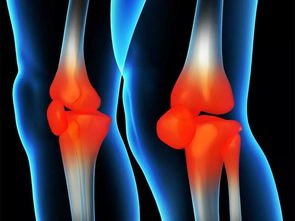 小金 x26amp 反饋 堯舜金不換養(yǎng)生貼風(fēng)濕骨病反饋篇 摸骨養(yǎng)生